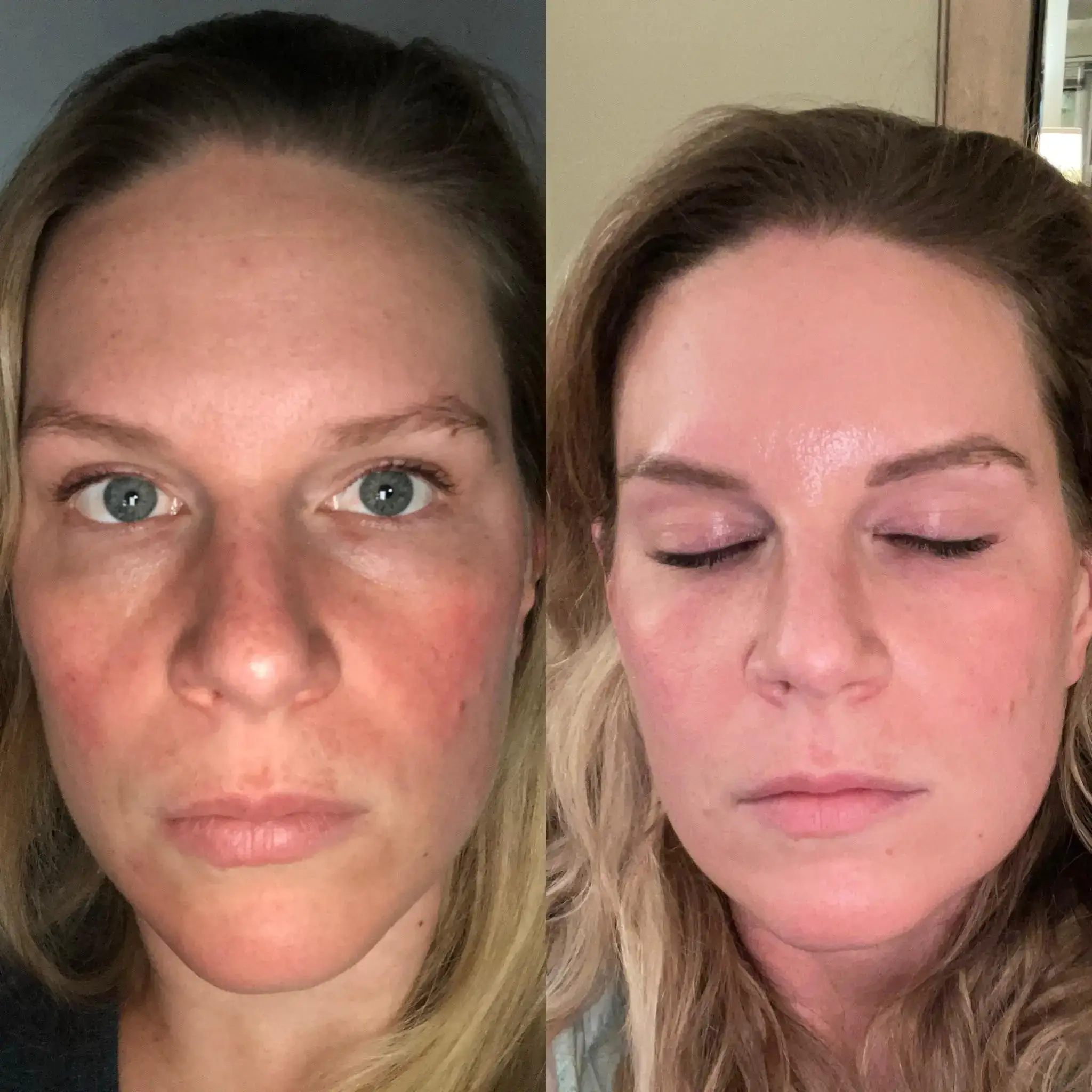 Resultado Anti-Aging